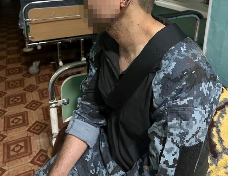 Детективи розслідують побиття моряка у військовій частині на Одещині
